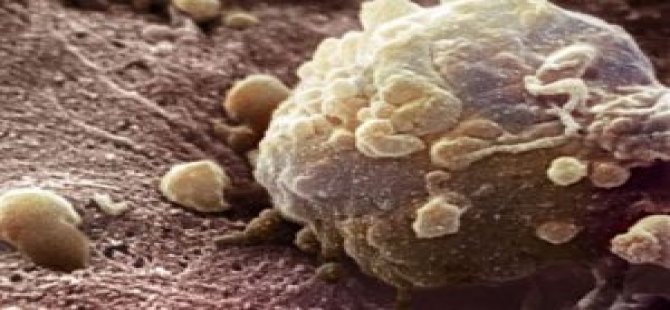 Biorezonans İle Kanser Tedavisi